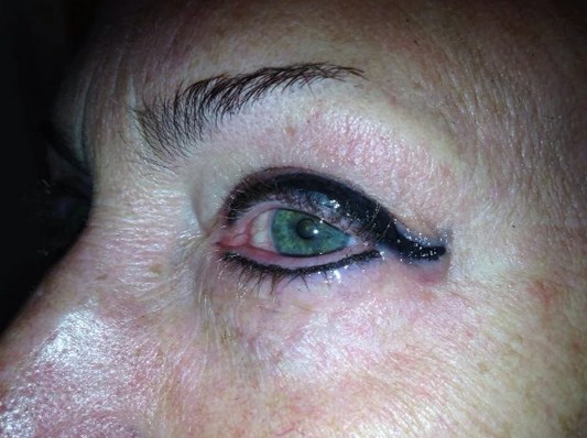 Oh No! Your Eyeliner Tattoo has Gone Wrong! Nanna To the Rescue!